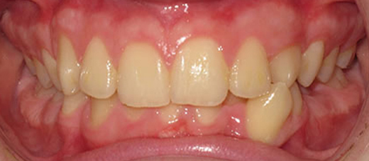 Before